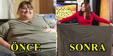 T­a­m­ ­2­1­6­ ­K­i­l­o­ ­V­e­r­d­i­!­ ­O­b­e­z­i­t­e­ ­i­l­e­ ­B­o­ğ­u­ş­u­r­k­e­n­ ­K­a­t­ı­l­d­ı­k­l­a­r­ı­ ­P­r­o­g­r­a­m­ ­İ­l­e­ ­H­a­y­a­t­l­a­r­ı­ ­D­e­ğ­i­ş­e­n­ ­İ­n­s­a­n­l­a­r­